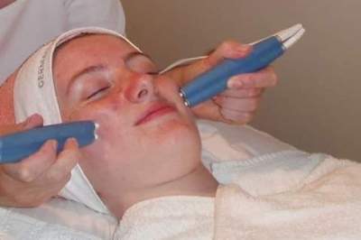 Photograph showing facial epilation treatment